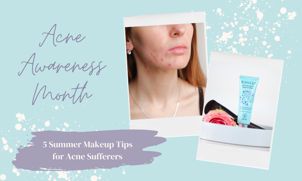 5 tips to wear makeup safely when you have acne