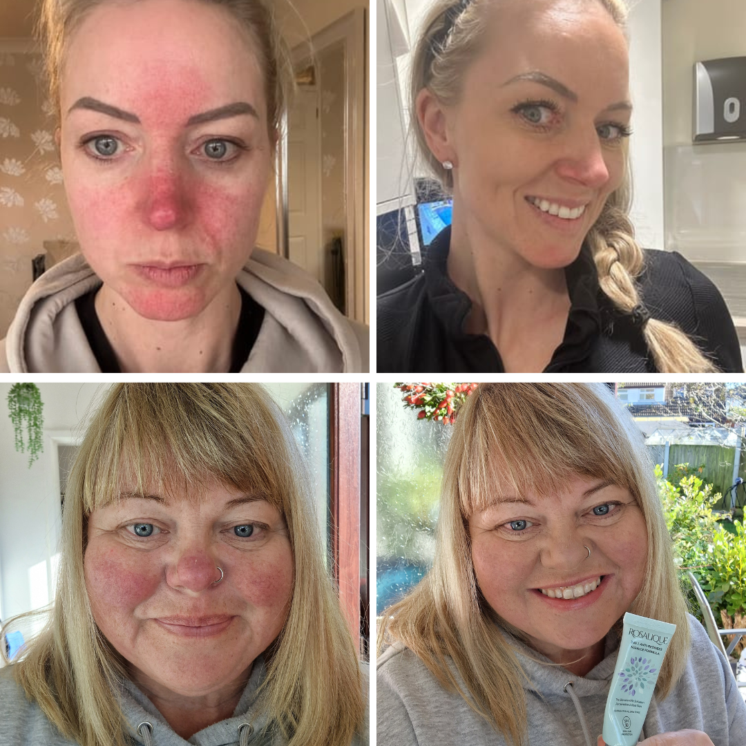 Rosalique 3 in 1 Anti-Redness Miracle Formula SPF50 Sample 3ml