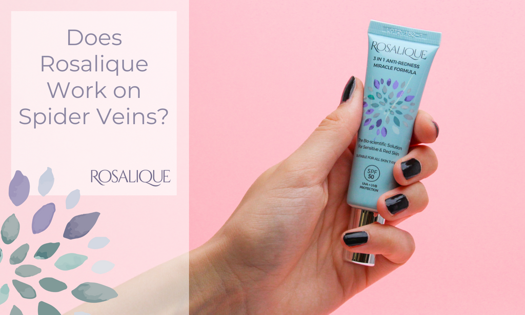 Does Rosalique work on spider veins?