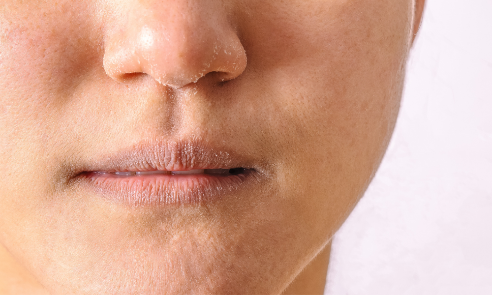 What makes Rosalique gentle on the skin - Our 5 active ingredients explained