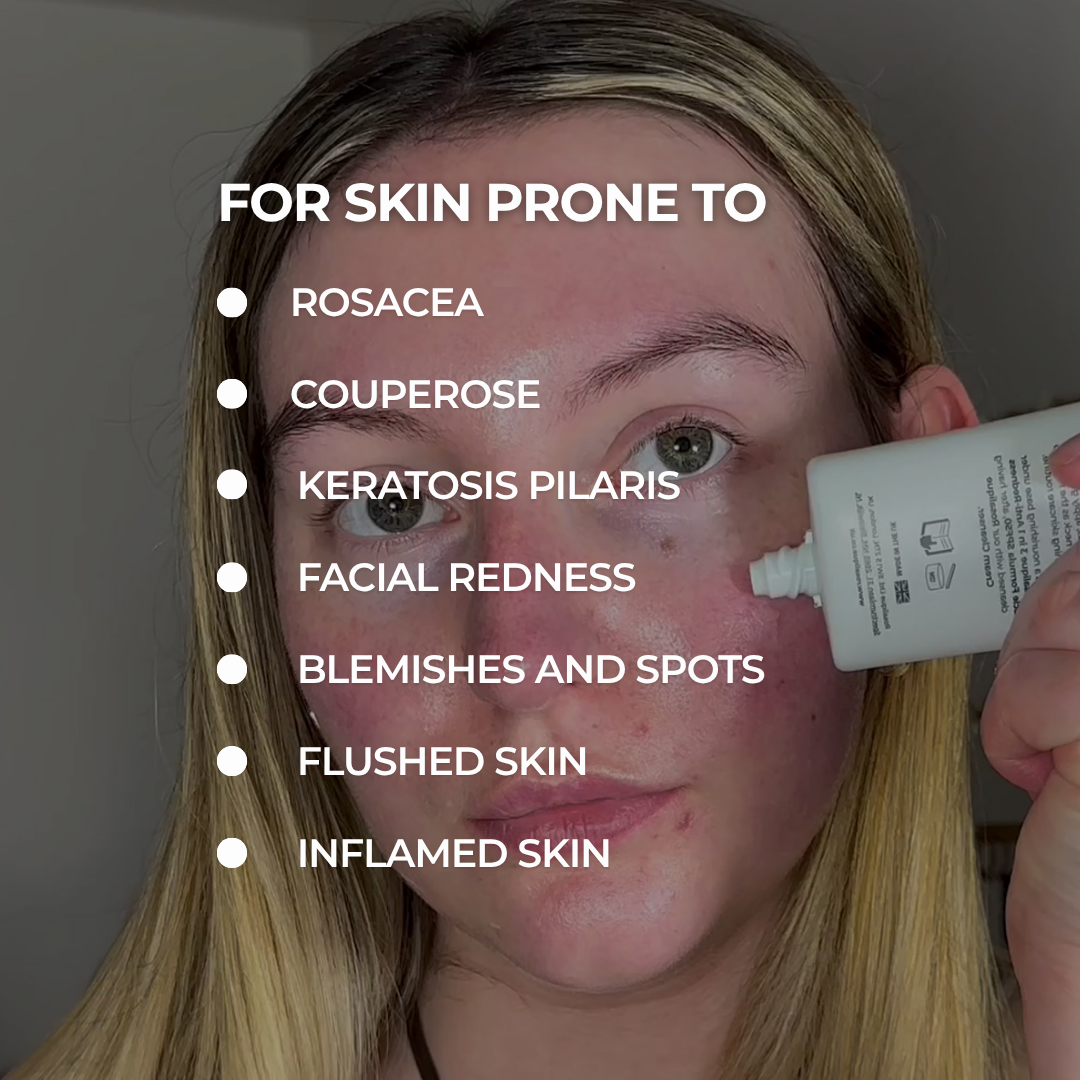Rosalique Redness Relief Day Cream
